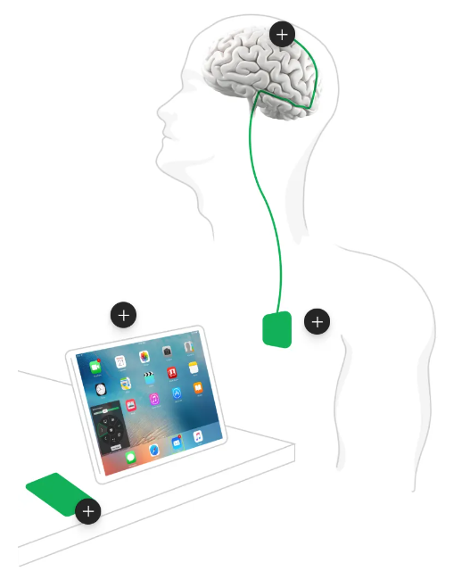脑机接口新突破：这家公司让OpenAI模型赋予渐冻症患者交流能力，让沟通变得更简单